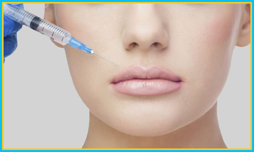 Fillers for Acne & Acne Scars Treatment in Hyderabad